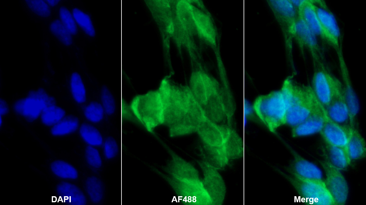 Monoclonal Antibody to Regenerating Islet Derived Protein 3 Gamma (REG3g)