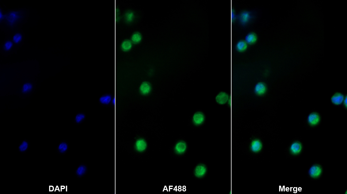 Monoclonal Antibody to Inhibitory Subunit Of NF Kappa B Epsilon (IkBe)