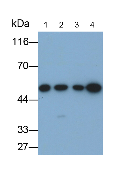 Monoclonal Antibody to Tubulin Beta 3 (TUBb3)