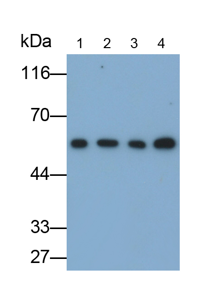 Monoclonal Antibody to Tubulin Beta 3 (TUBb3)