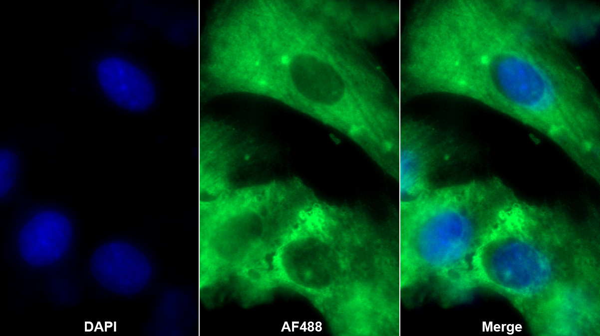 Monoclonal Antibody to Tau-Tubulin Kinase 2 (tTBK2)