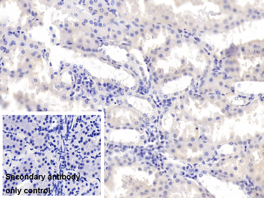 Monoclonal Antibody to Annexin A3 (ANXA3)