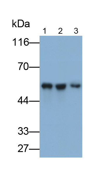 Monoclonal Antibody to Aldehyde Dehydrogenase 7 Family, Member A1 (ALDH7A1)