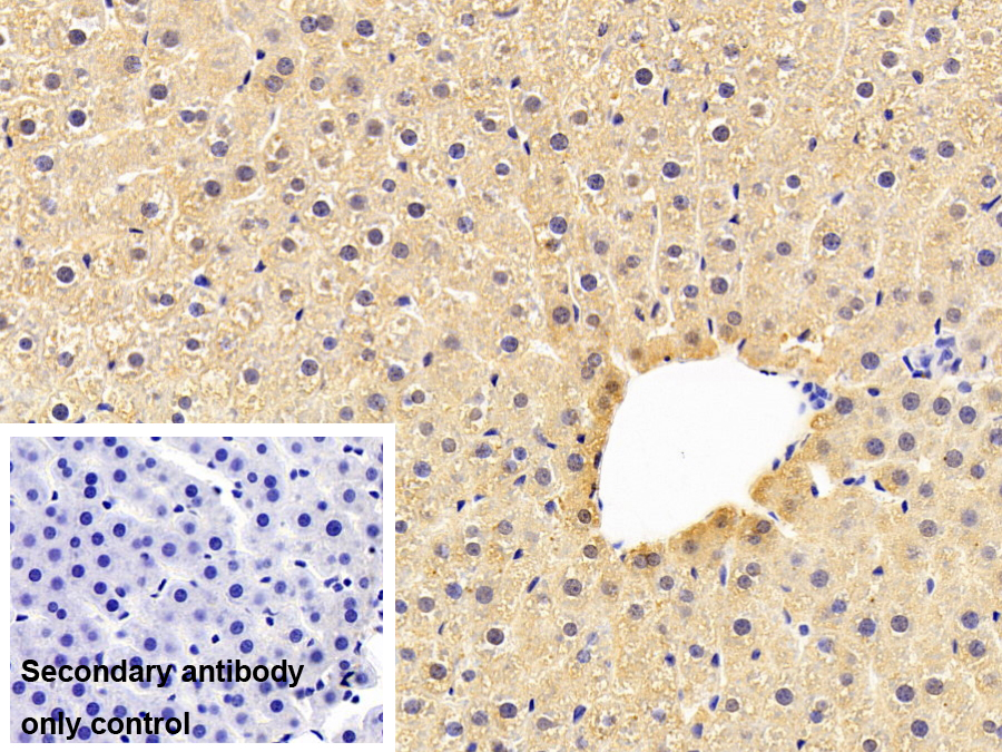 Monoclonal Antibody to Complement Component 1, Q Subcomponent C (C1qC)