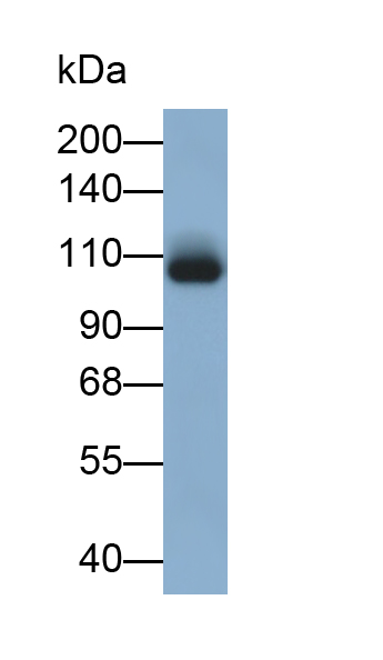 Monoclonal Antibody to Histone Deacetylase 4 (HDAC4)