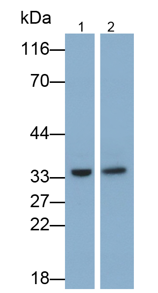 Monoclonal Antibody to Sirtuin 3 (SIRT3)