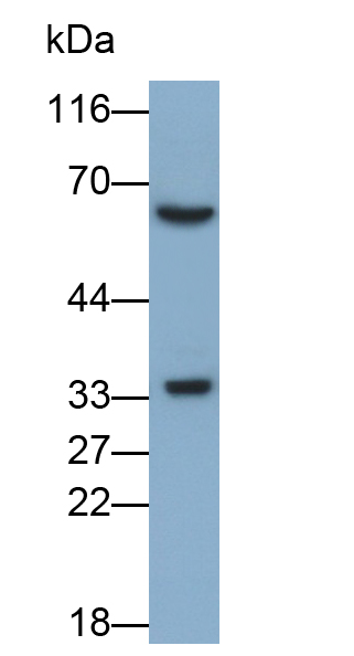Monoclonal Antibody to Sirtuin 3 (SIRT3)