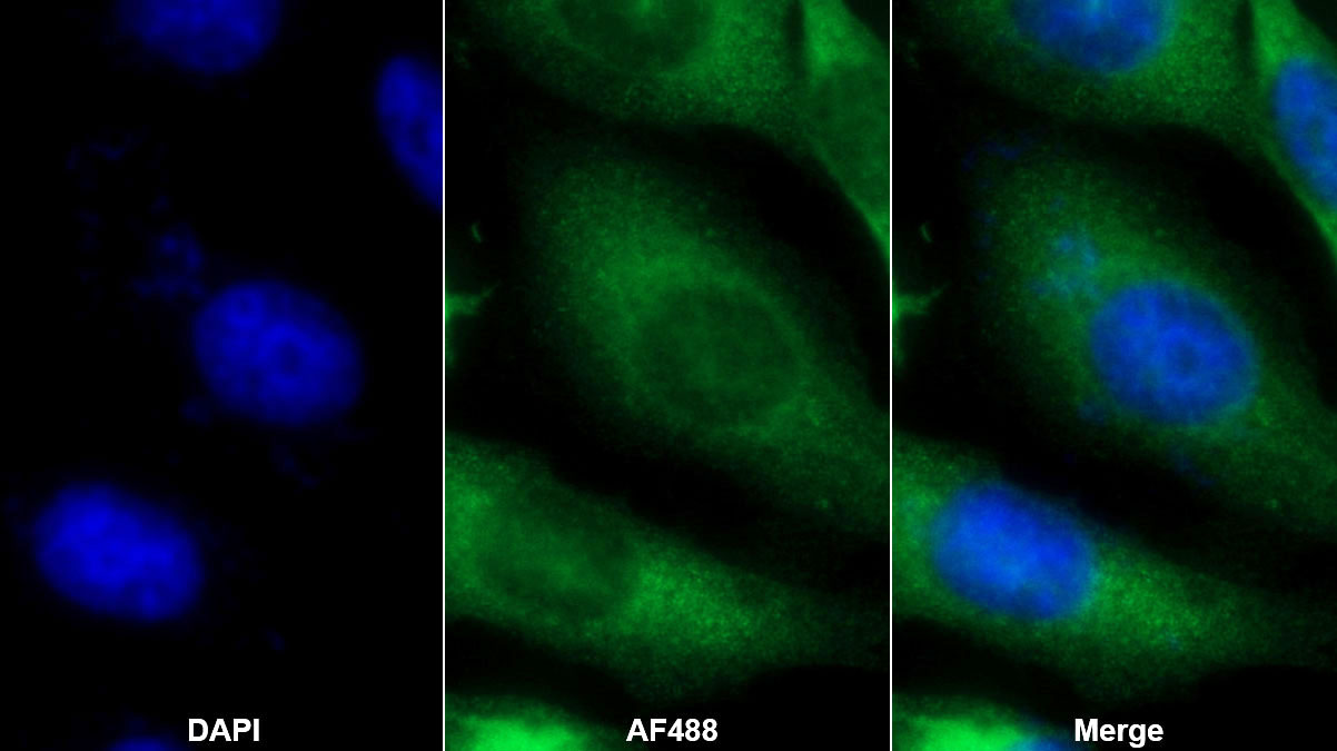 Monoclonal Antibody to Heat Shock Protein Beta 6 (HSPb6)