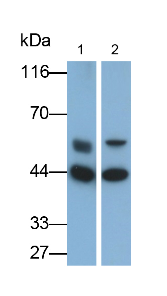 Monoclonal Antibody to Purinergic Receptor P2X, Ligand Gated Ion Channel 7 (P2RX7)