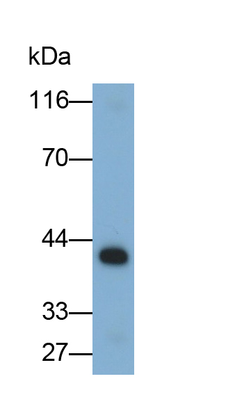 Monoclonal Antibody to Cysteine Rich Protein, Angiogenic Inducer 61 (CYR61)