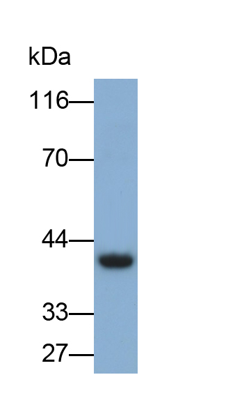 Monoclonal Antibody to Cysteine Rich Protein, Angiogenic Inducer 61 (CYR61)