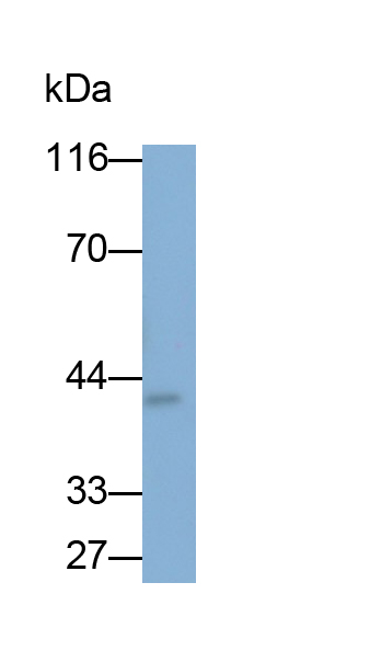 Monoclonal Antibody to Cysteine Rich Protein, Angiogenic Inducer 61 (CYR61)