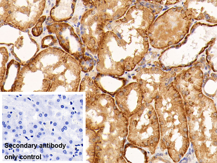 Monoclonal Antibody to ATPase, Na+/K+ Transporting Alpha 1 Polypeptide (ATP1a1)