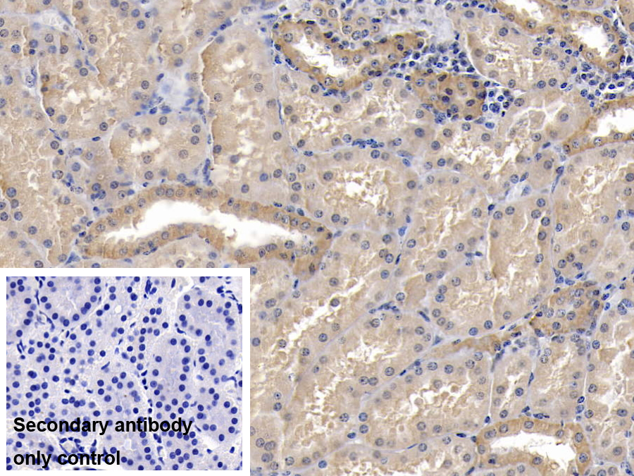 Monoclonal Antibody to ATPase, Na+/K+ Transporting Alpha 1 Polypeptide (ATP1a1)