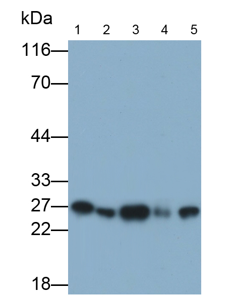 Monoclonal Antibody to Ubiquitin Carboxyl Terminal Hydrolase L1 (UCHL1)