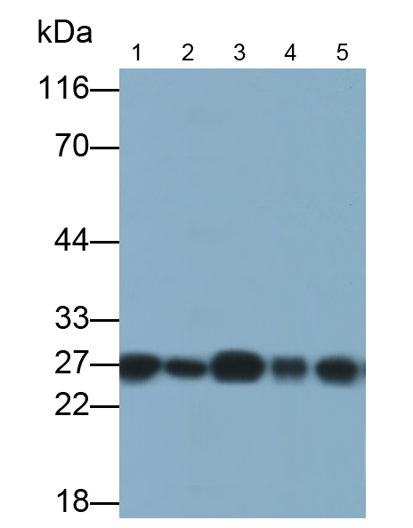 Monoclonal Antibody to Ubiquitin Carboxyl Terminal Hydrolase L1 (UCHL1)