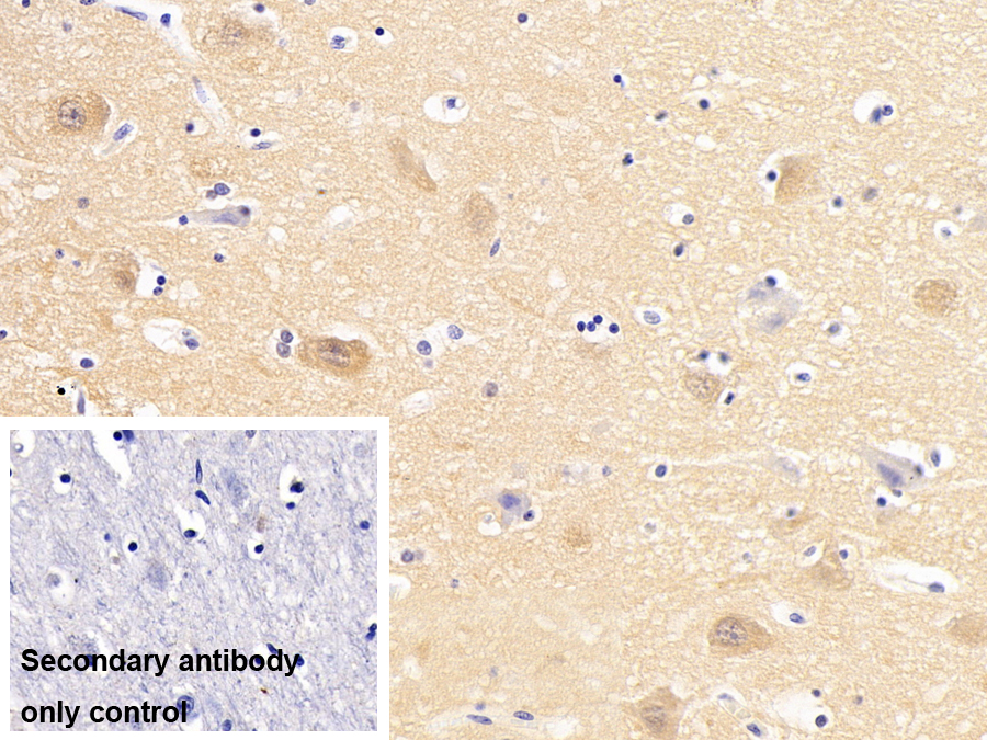 Monoclonal Antibody to Ubiquitin Carboxyl Terminal Hydrolase L1 (UCHL1)