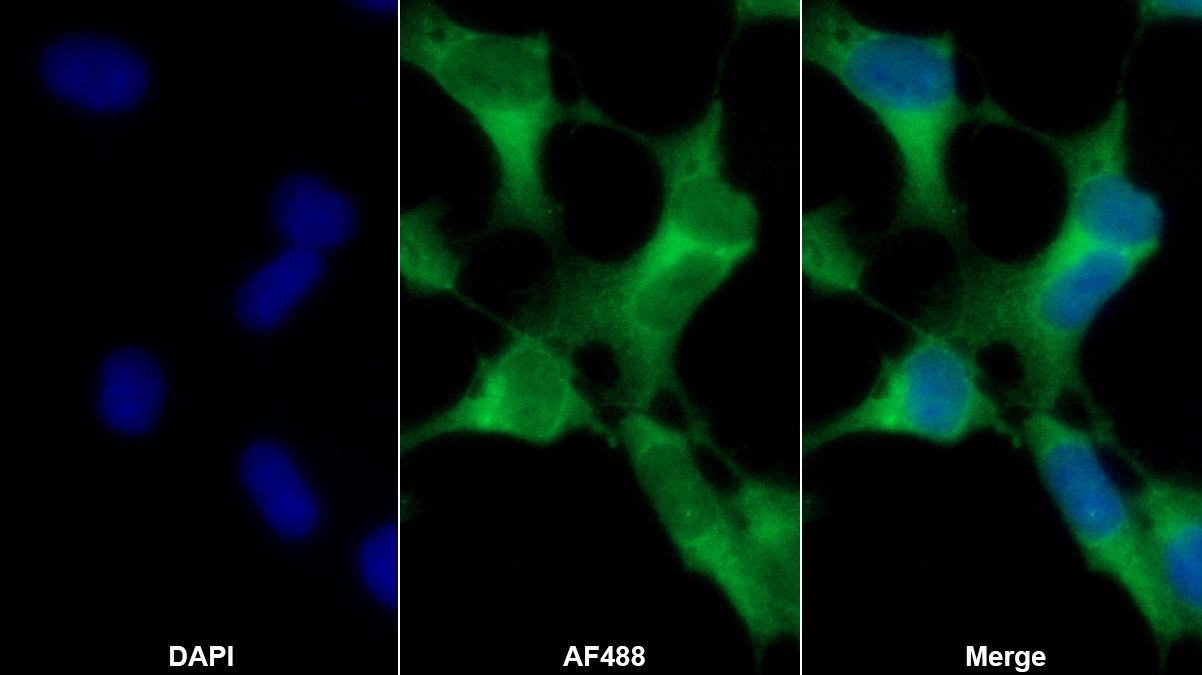 Monoclonal Antibody to Ubiquitin Carboxyl Terminal Hydrolase L1 (UCHL1)