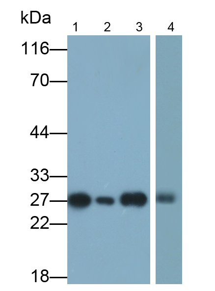 Monoclonal Antibody to Ubiquitin Carboxyl Terminal Hydrolase L1 (UCHL1)