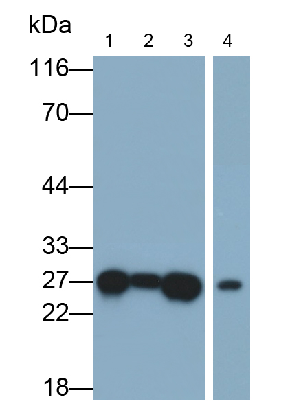 Monoclonal Antibody to Ubiquitin Carboxyl Terminal Hydrolase L1 (UCHL1)