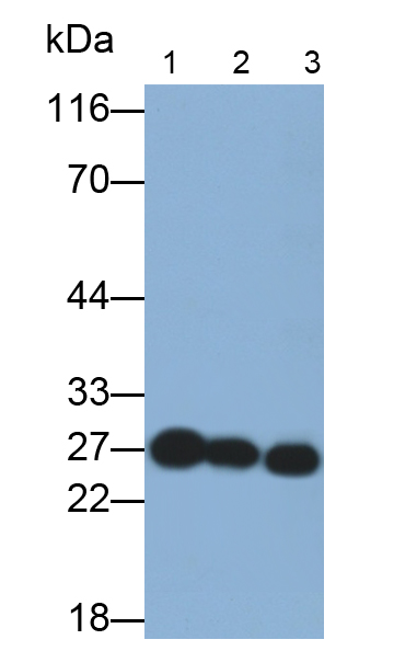 Monoclonal Antibody to Ubiquitin Carboxyl Terminal Hydrolase L1 (UCHL1)