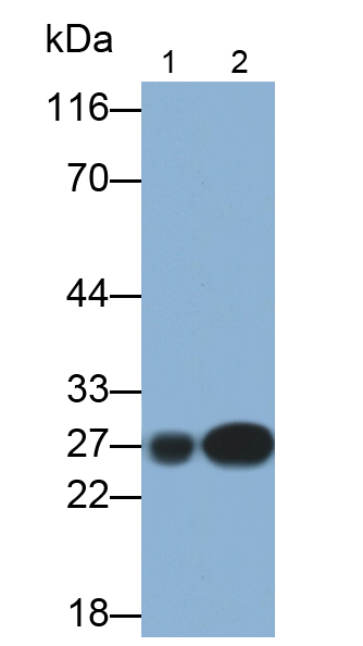 Monoclonal Antibody to Ubiquitin Carboxyl Terminal Hydrolase L1 (UCHL1)