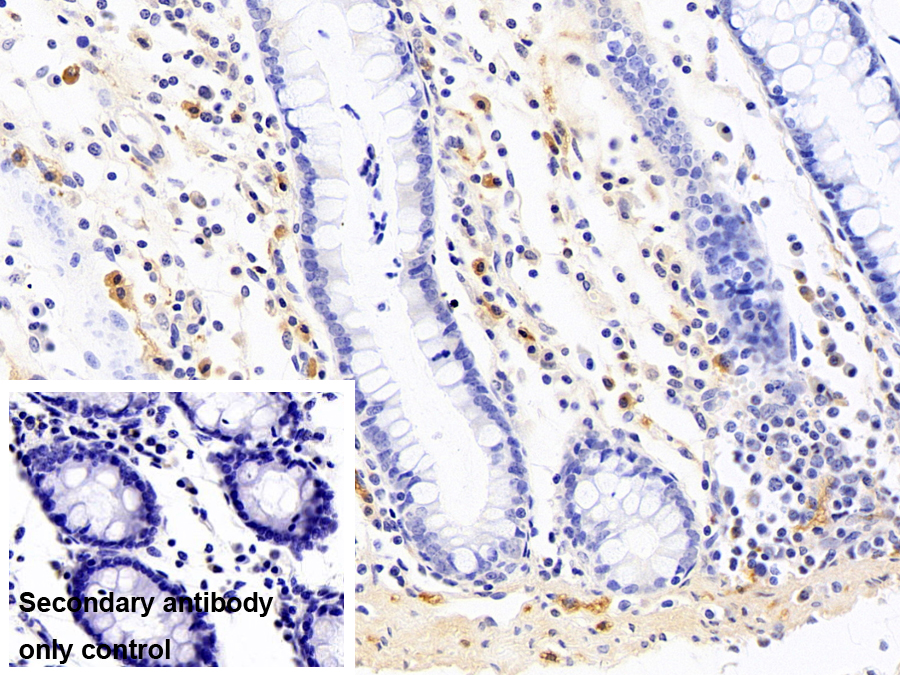 Monoclonal Antibody to Ubiquitin Carboxyl Terminal Hydrolase L1 (UCHL1)
