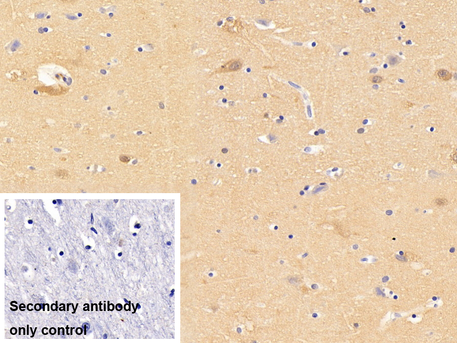 Monoclonal Antibody to Ubiquitin Carboxyl Terminal Hydrolase L1 (UCHL1)