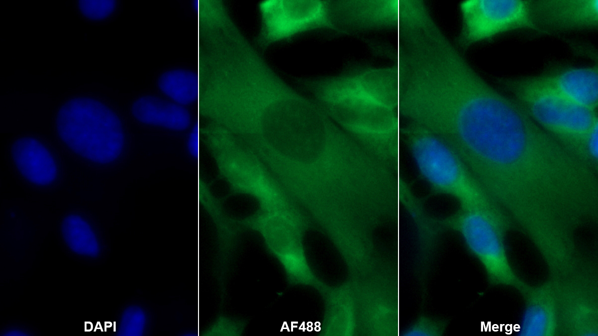 Monoclonal Antibody to Ubiquitin Carboxyl Terminal Hydrolase L1 (UCHL1)