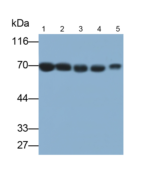 Monoclonal Antibody to Transketolase (TKT)