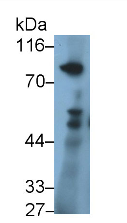 Monoclonal Antibody to Nexilin (NEXN)