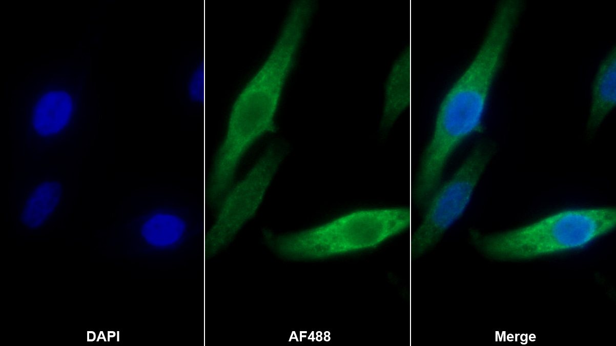 Monoclonal Antibody to Mesothelin (MSLN)