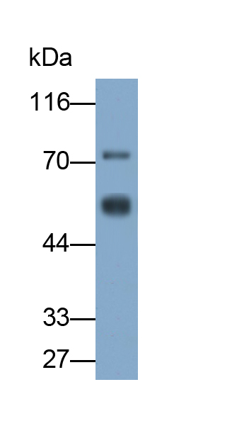 Monoclonal Antibody to Mesothelin (MSLN)