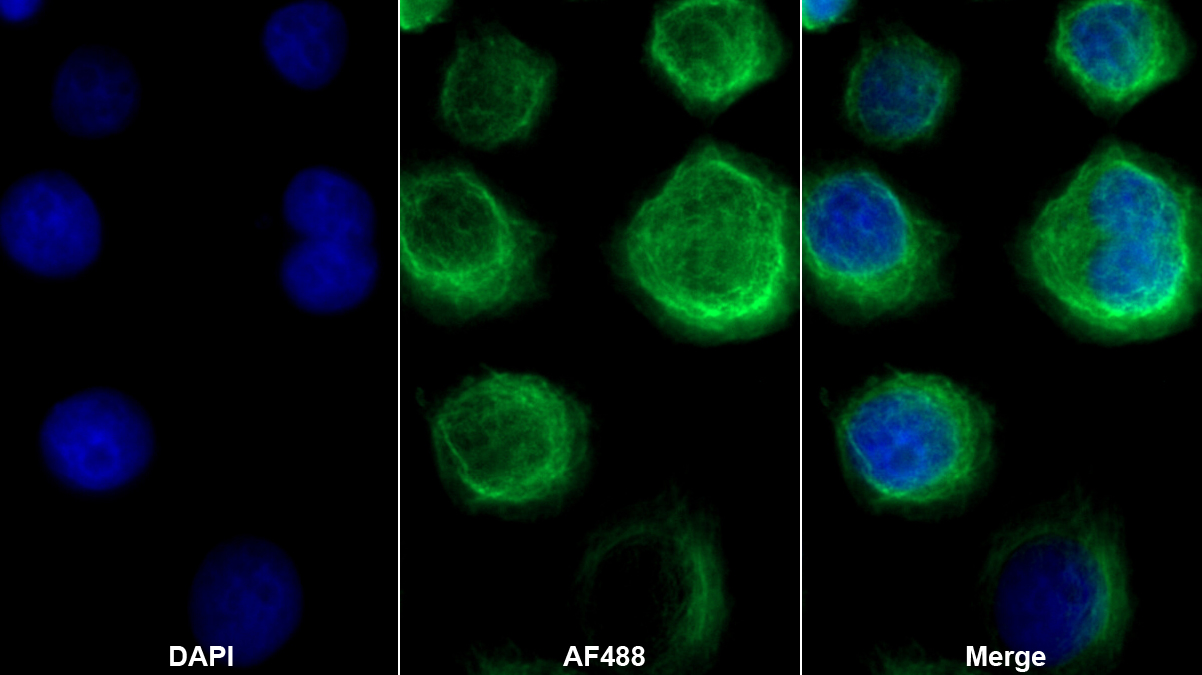 Monoclonal Antibody to Cystatin 1 (CST1)