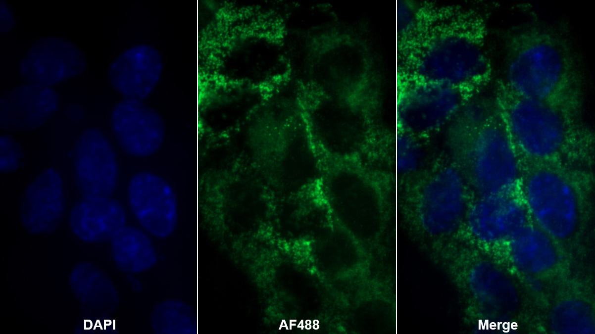 Monoclonal Antibody to Succinate Dehydrogenase Complex Subunit A (SDHA)