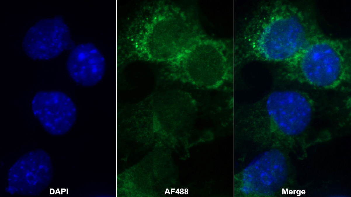 Monoclonal Antibody to Succinate Dehydrogenase Complex Subunit A (SDHA)