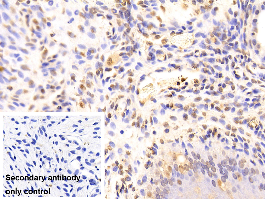 Monoclonal Antibody to Snail Homolog 1 (SNAI1)