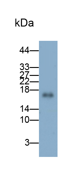 Monoclonal Antibody to Niemann Pick Disease Type C2 (NPC2)