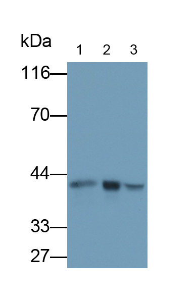 Monoclonal Antibody to Alpha-2-Glycoprotein 1, Zinc Binding (aZGP1)