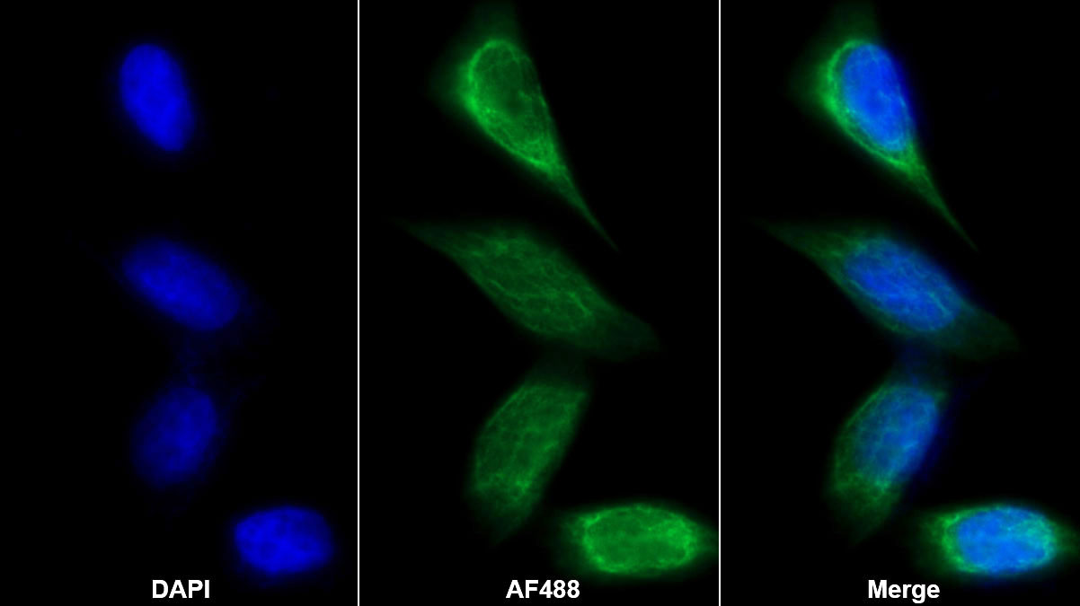 Monoclonal Antibody to Alpha-2-Glycoprotein 1, Zinc Binding (aZGP1)