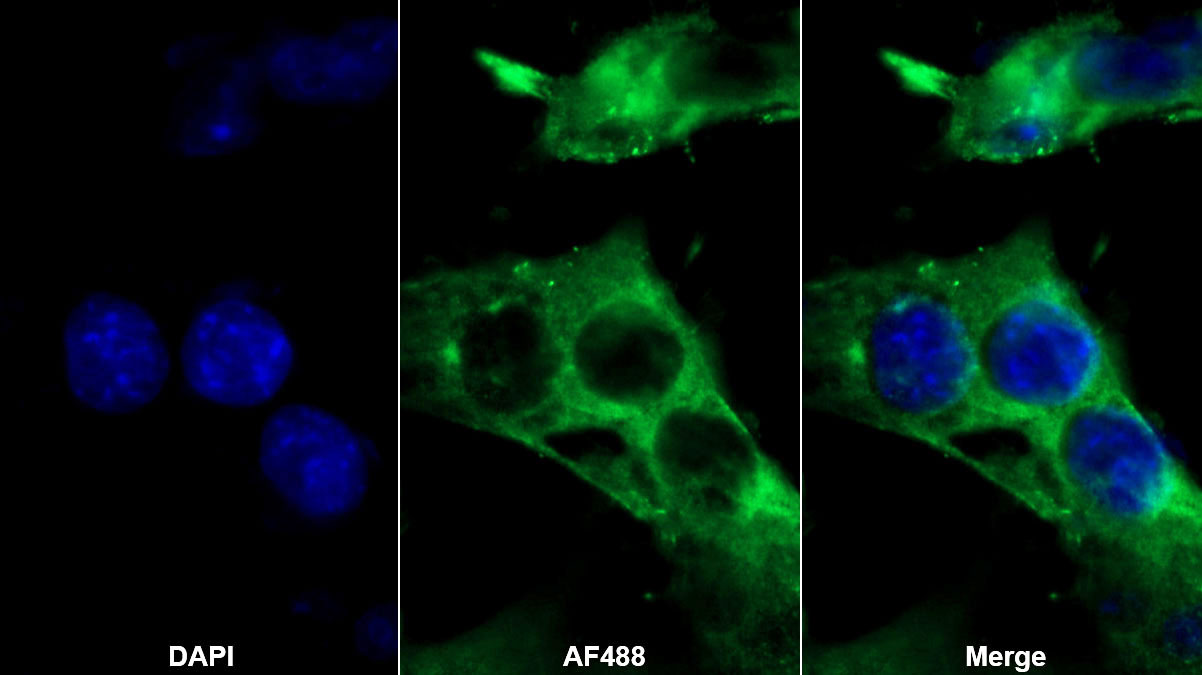 Monoclonal Antibody to Interleukin 1 Family, Member 9 (IL1F9)