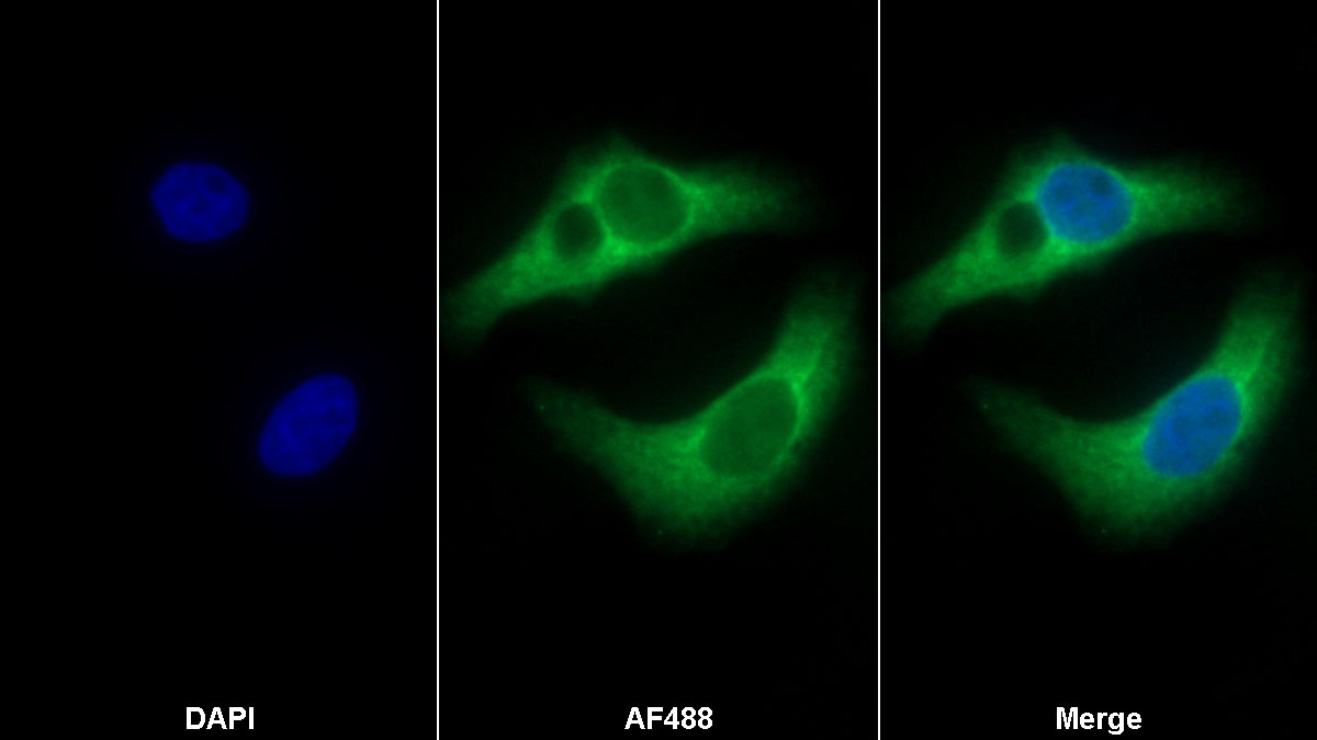 Monoclonal Antibody to Myxovirus Resistance 2 (MX2)