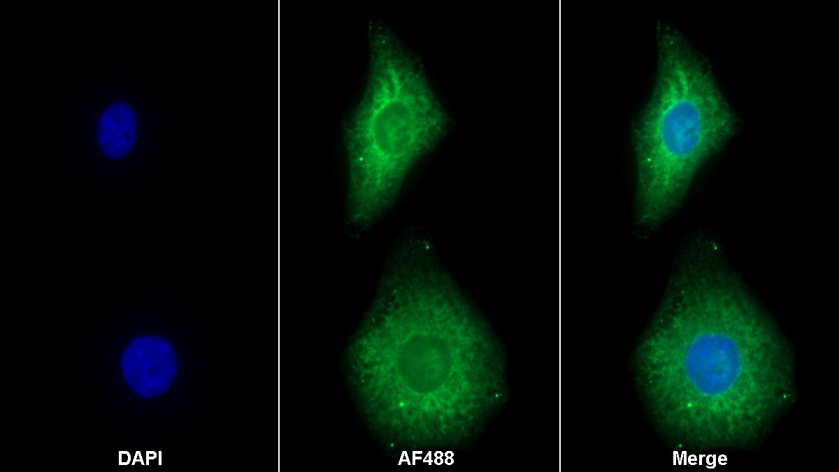 Monoclonal Antibody to Myxovirus Resistance 2 (MX2)