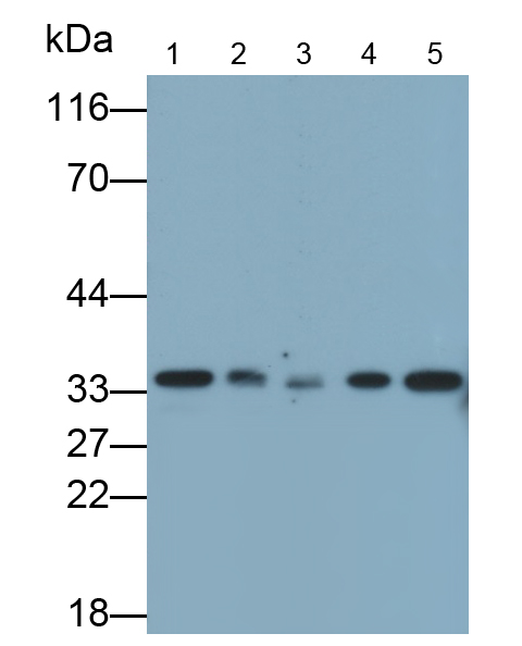 Monoclonal Antibody to NADH Dehydrogenase, Quinone 1 (NQO1)