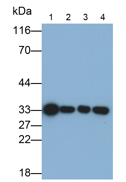 Monoclonal Antibody to NADH Dehydrogenase, Quinone 1 (NQO1)