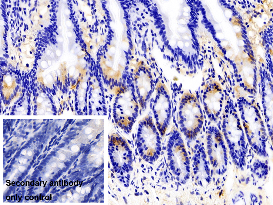 Monoclonal Antibody to NADH Dehydrogenase, Quinone 1 (NQO1)