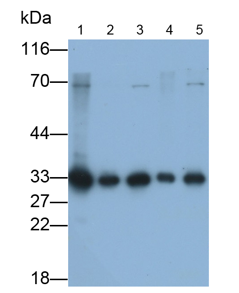 Monoclonal Antibody to NADH Dehydrogenase, Quinone 1 (NQO1)