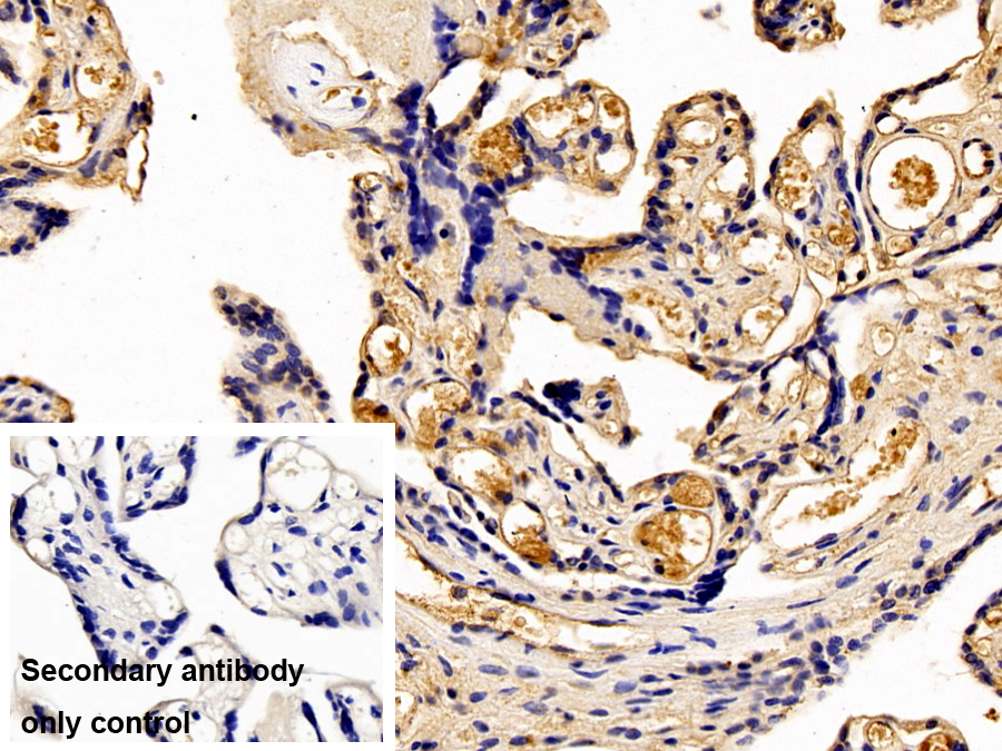 Monoclonal Antibody to Esophageal Cancer Related Gene 4 (ECRG4)