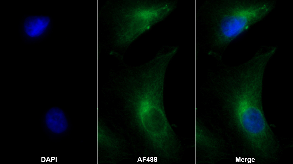 Monoclonal Antibody to Proteasome 26S Subunit, Non ATPase 10 (PSMD10)