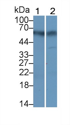 Monoclonal Antibody to Amylase Alpha 2B, Pancreatic (AMY2B)